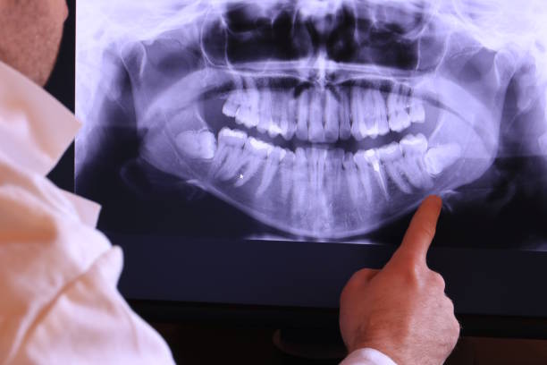 Best Broken or Cracked Tooth Emergency Dentist in Brooklyn Park, MD
